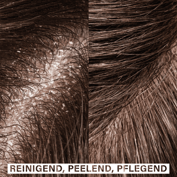 Scalp Exfoliating Shampoo