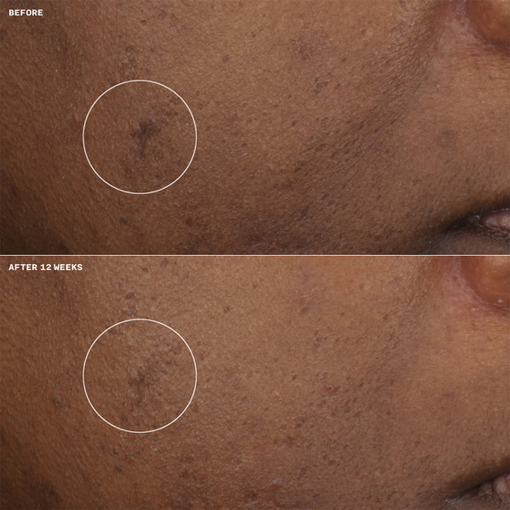 Even Better Clinical - Brightening Moisturizer