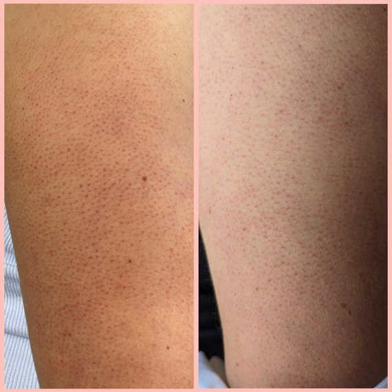 Glycolic Body Scrub