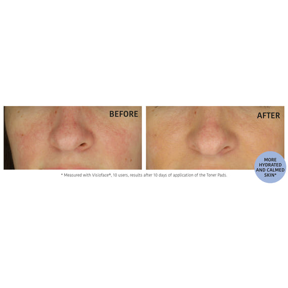 Hydrating Toner Pre-soaked Pads with Cica & Blueberry