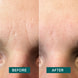 Facial Patches Panthenol