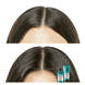 Scalp Advanced Anti-Discomfort Dermo-Regulator Shampoo