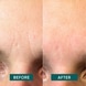 Facial Patches Aloe Vera