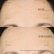 Overnight Treatment