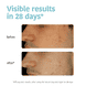 Prevent & Correct Anti-Blemish Face Serum with Salicylic Acid