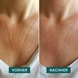 Decolleté Pad Vitamin C