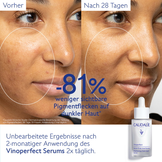 Serum Anti-Pigmentflecken