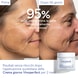 Crema Anti-Macchie Niacinamide