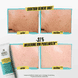 Expertly Clear Blemish Treating & Preventing Lotion