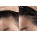 301 LED Hair Strengthening Scalp Massager