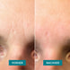 Gesicht Patches mit Ectoin