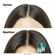 Scalp Advanced Anti-Discomfort Dermo-Regulator Shampoo - Refill