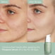 Blemish Control Serum