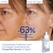 Serum Anti-Pigmentflecken