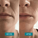 Mouth Patches with Aloe Vera