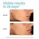 Oil Contol Anti-Blemish Face Cream with Salicylic Acid