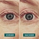 Augen Pads Hyaluron „ocean eyes“