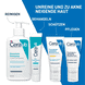 Anti-Unreinheiten Gel
