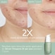 Sérum Anti-Imperfections