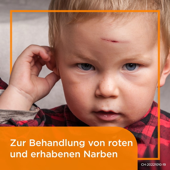 Narben-Gel
