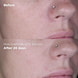 Siero Niacinamide 10% + Zinco 1%