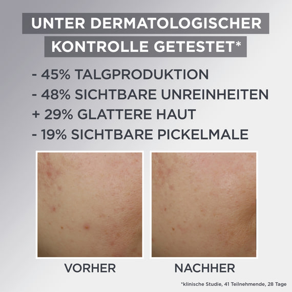 Gesichtscreme 3in1 Mattierende Air Cream AHA+BHA