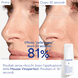 Mousse Micro-Peeling