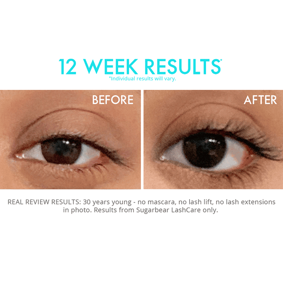 Lashcare Vitamin Serum