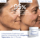 Anti-Pigmentflecken Creme Niacinamid