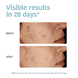 Purifying Anti-Blemish Cleansing Gel with Salicylic Acid