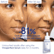 Brightening Dark Spot Serum
