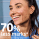 Prevent & Correct Anti-Blemish Face Serum with Salicylic Acid