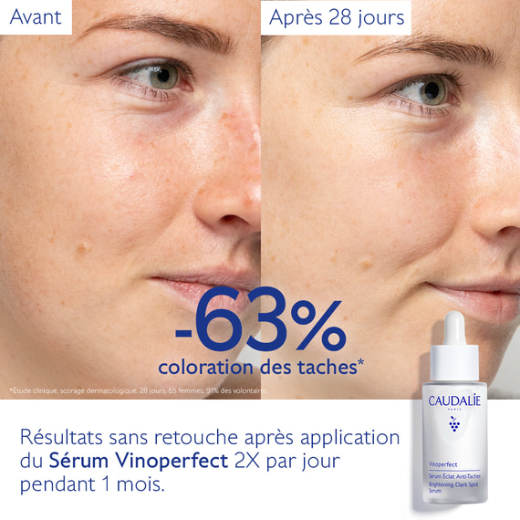 Sérum Éclat Anti-Taches
