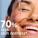 Prevent & Correct Anti-Blemish Face Serum with Salicylic Acid