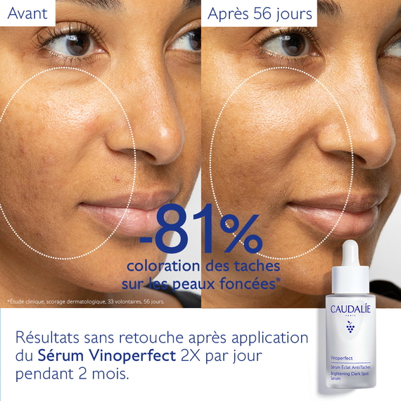 Sérum Éclat Anti-Taches