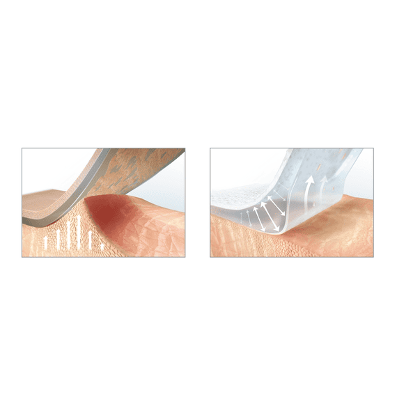 Ultra Sensitive XL Silicone Plaster