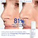Micropeel Foam