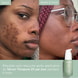 Sérum Anti-Imperfections