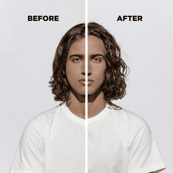 Anti Hair Loss Serum