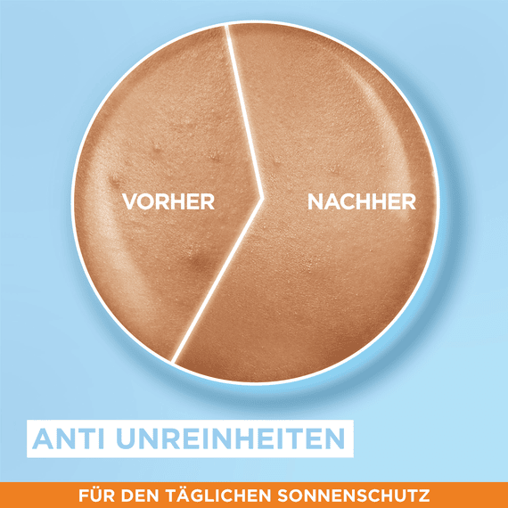 Sensitive expert+ Super UV-Schutz Fluid mit Hyaluronsäure LSF 50