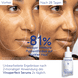 Serum Anti-Pigmentflecken