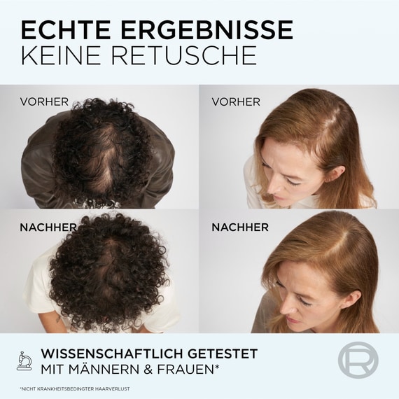 Fiber Booster Anti-Hair Loss Shampoo