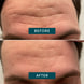 Gesicht Patches mit Aloe Vera