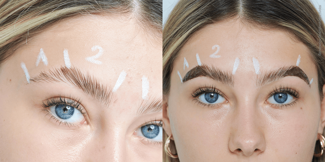 The eyebrows have been divided into 2 zones, these have been marked with circles.