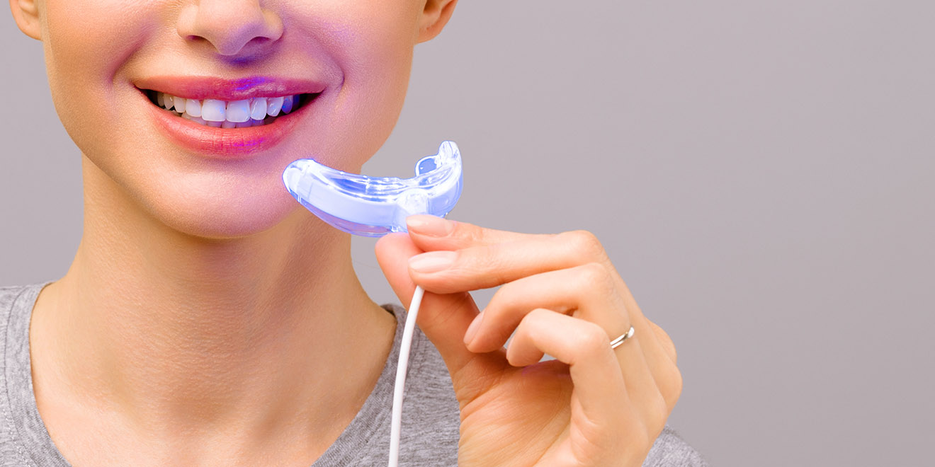 Une femme aux dents blanches tient une gouttière dentaire avec une lumière LED
